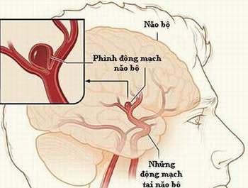 Nang thận là gì? triệu chứng và hình thành thế nào? - ảnh 2