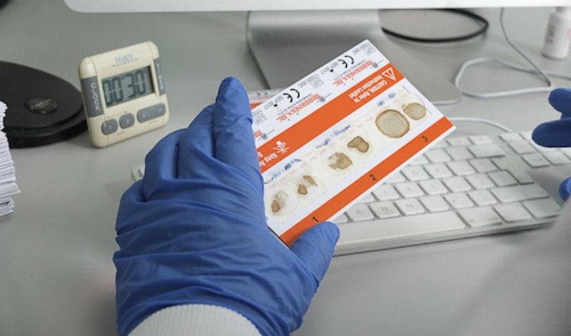 Các xét nghiệm tìm máu ẩn trong phân - ảnh 1