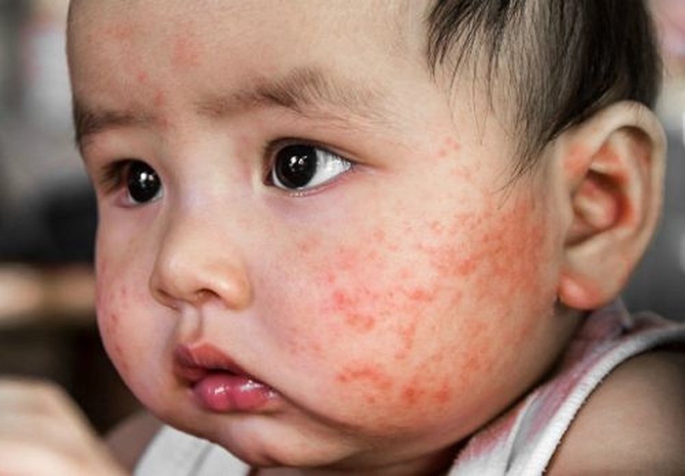 Có nên dùng kem dưỡng ẩm cho trẻ sơ sinh? - ảnh 1