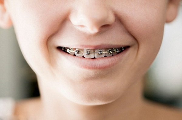 Chụp X quang răng được chỉ định trong trường hợp nào? - ảnh 1