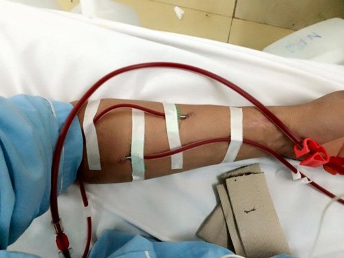 Quy trình lọc máu cho người bệnh tiểu đường: Những điều cần chú ý - ảnh 1
