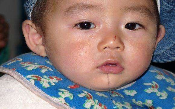 Hay chảy nước miếng vì trẻ đau họng