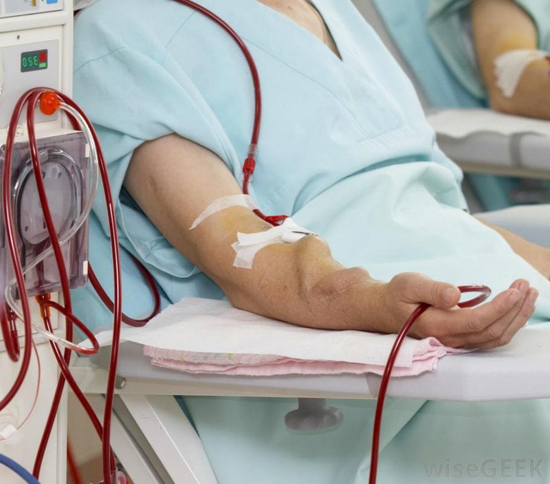 Quy trình lọc máu cho người bệnh tiểu đường: Những điều cần chú ý - ảnh 3