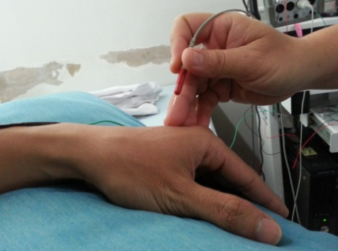 Kích thích điện thần kinh cơ điều trị rối loạn nuốt - ảnh 2