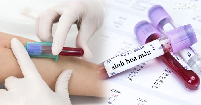 xét nghiệm sinh hóa máu