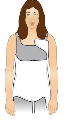 Nẹp thân dưới nách