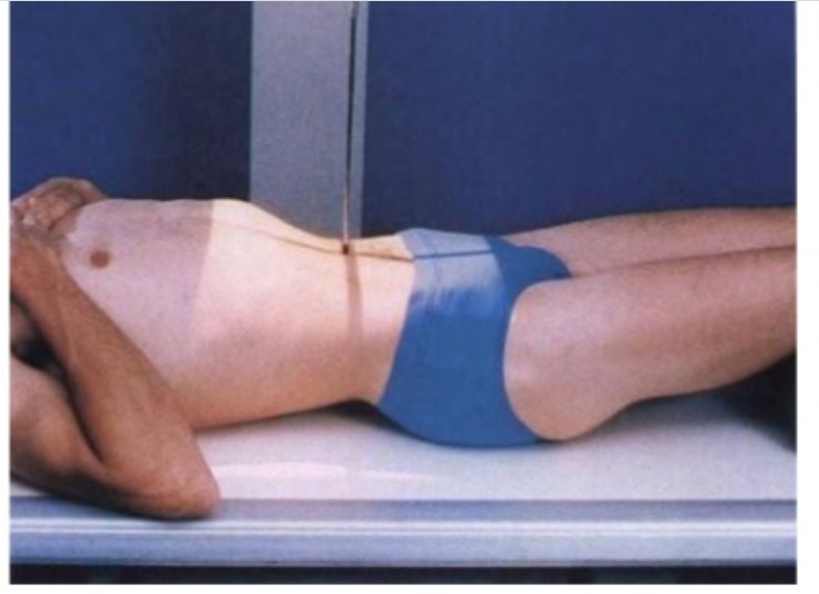 tư thế xquang hệ tiết niệu không chuẩn bị