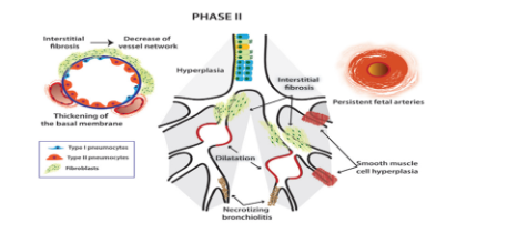 Giai đoạn 2 của LSPQP