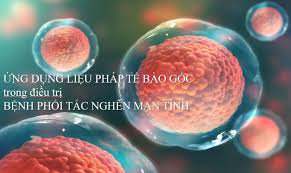Ứng dụng Tế bào gốc trong bệnh phổi tắc nghẽn mạn tính