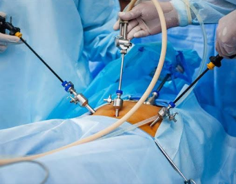 Phẫu thuật nội soi