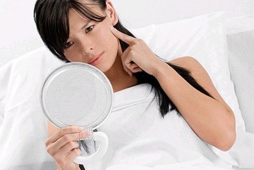 nguyen-nhan-cua-da-dau-la-gi-2