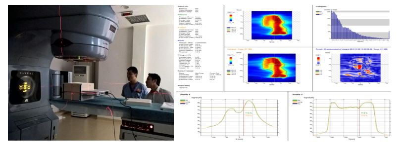 Chiếu xạ kế hoạch lên phantom và đo liều thực tế so với liều tính toán trên kế hoạch để kiểm tra chất lượng kế hoạch trước xạ trị.