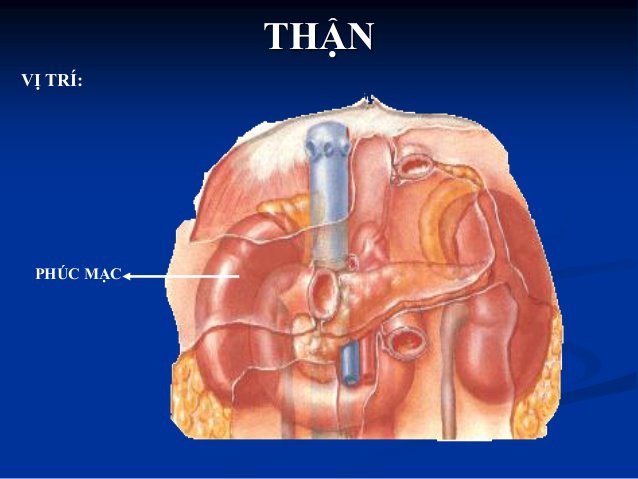nang thận sau phúc mạc