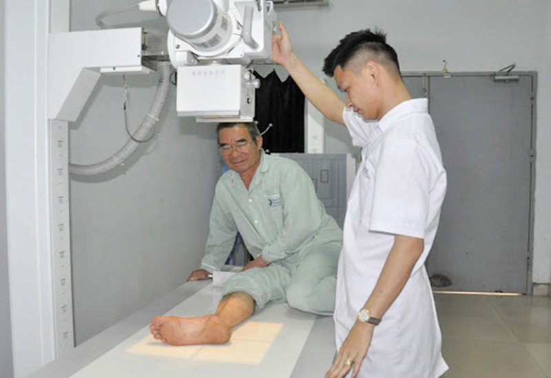 x-quang xương cẳng chân