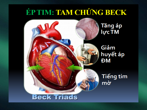 Dấu hiệu mạch đảo.