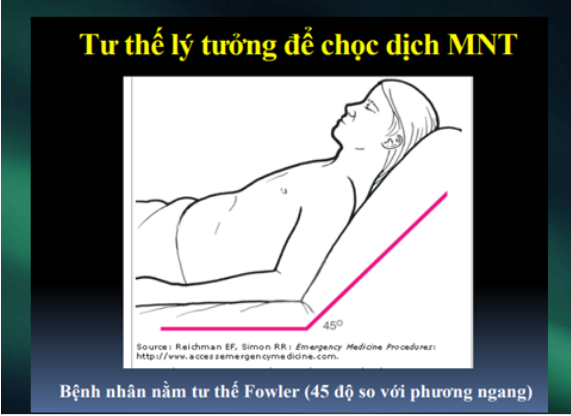 Tư thế nằm