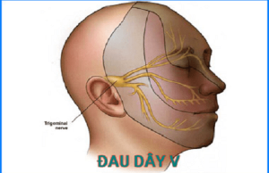 Đau dây thần kinh số V