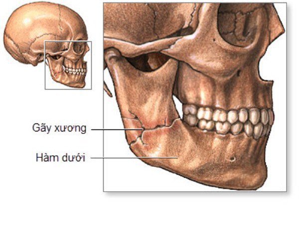 Xương hàm dưới
