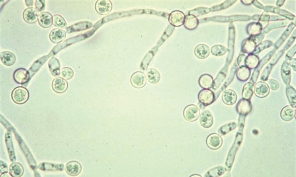 Nấm Candida